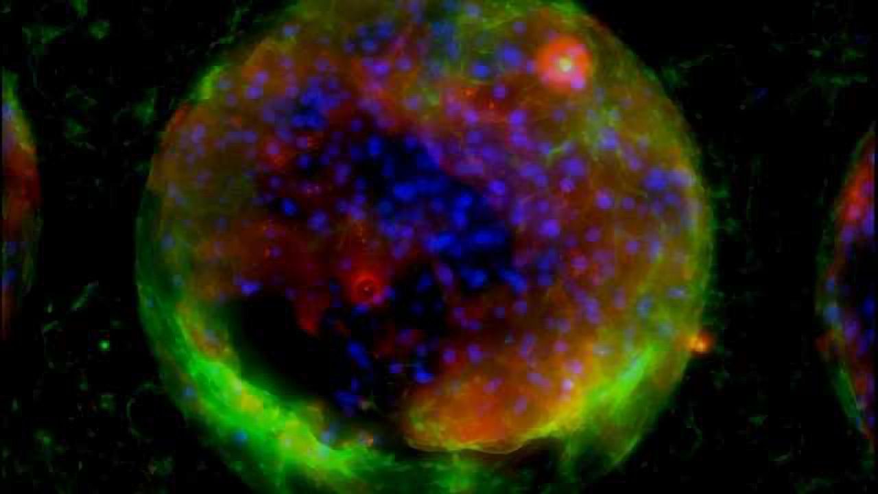 Liver-on-a-chip Used to Test Hepatitis B Virus Infection