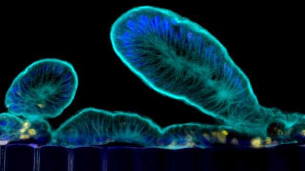 From Human Biopsy to Complex Gut Physiology on a Chip