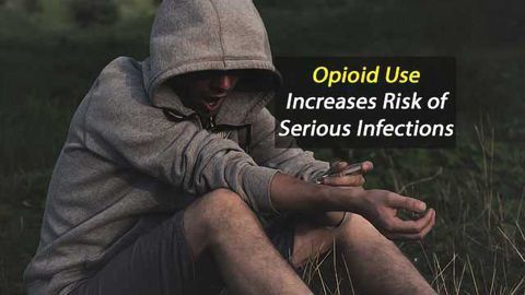 Opioid Use Increases Risk of Serious Infections