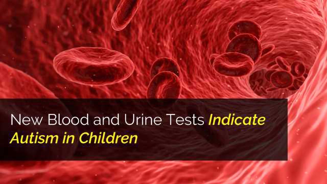 New Blood and Urine Tests Indicate Autism in Children