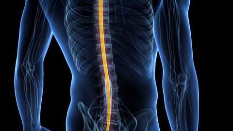 Electrical Implant Reduces "Invisible" Symptoms of Man's Spinal Cord Injury- Study