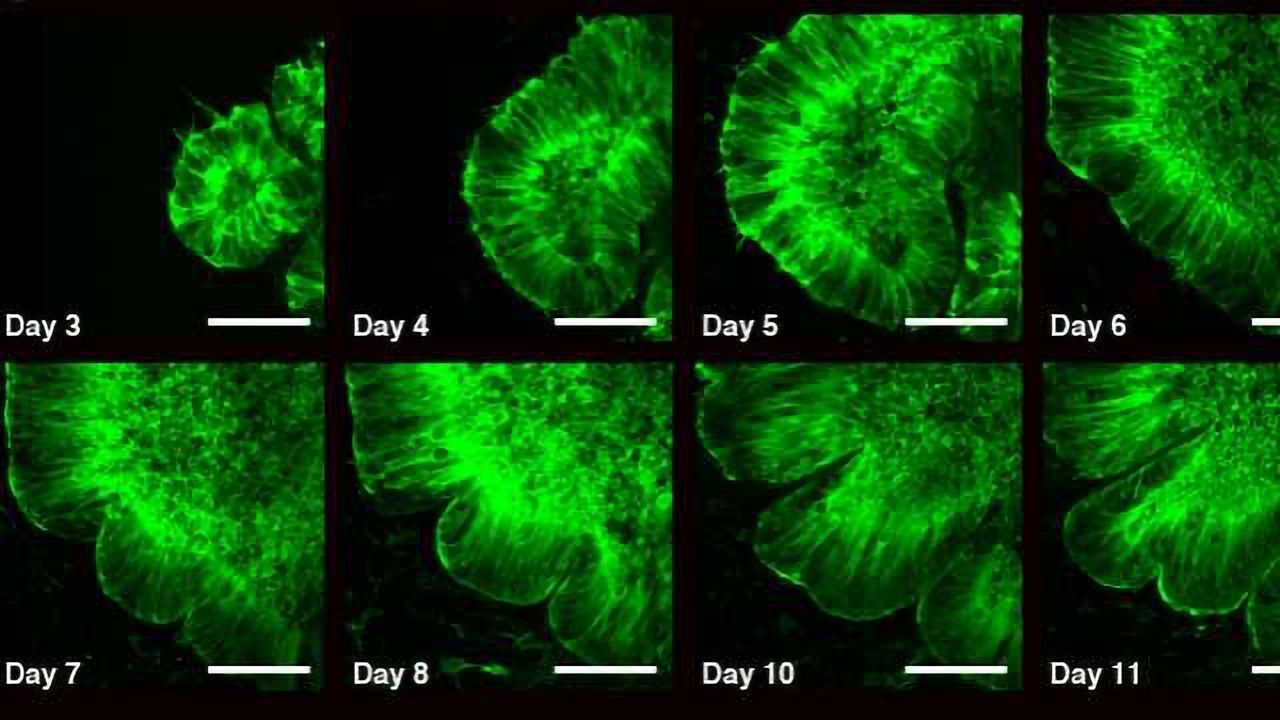 ‘Brain on a Chip’ Reveals How the Brain Folds