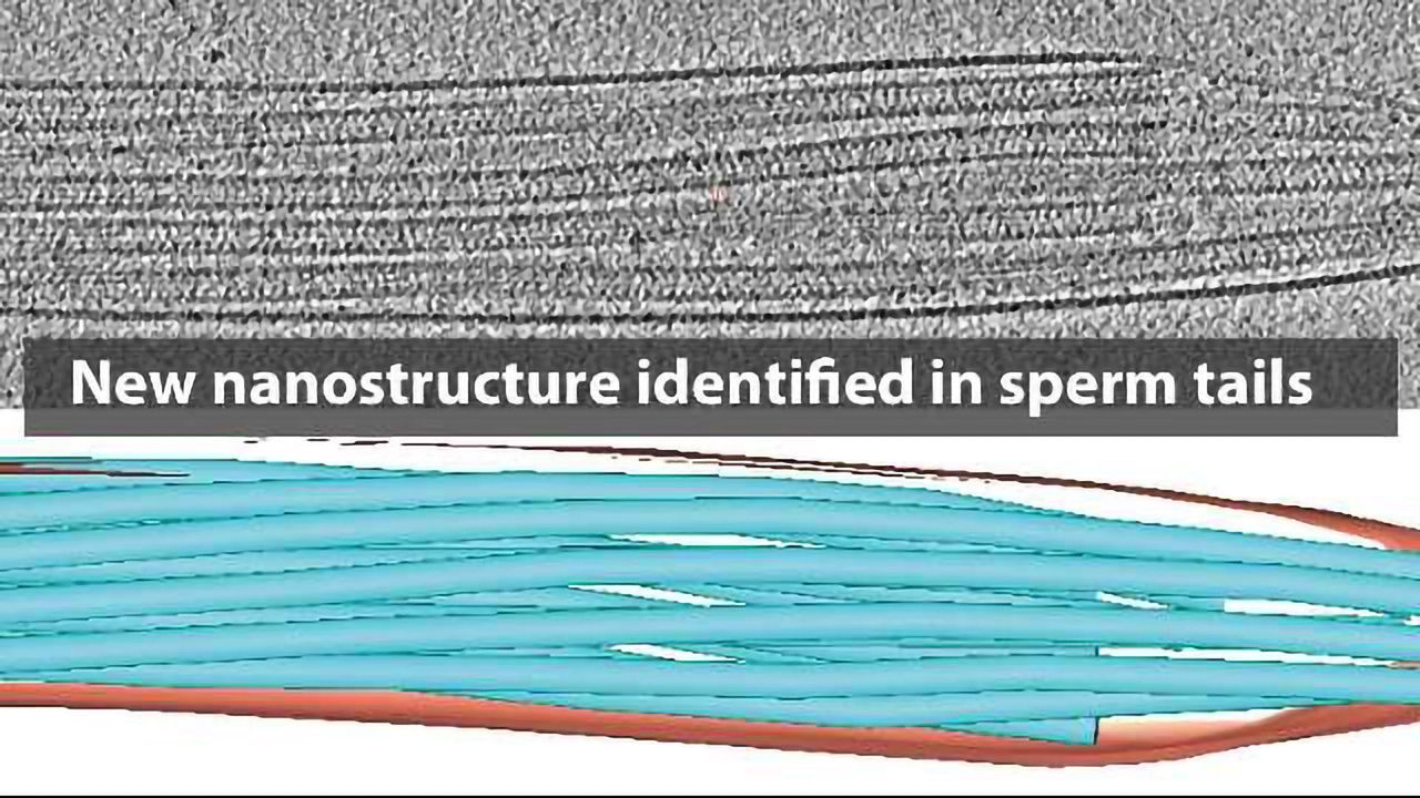 New Structure Discovered in Human Sperm Tails