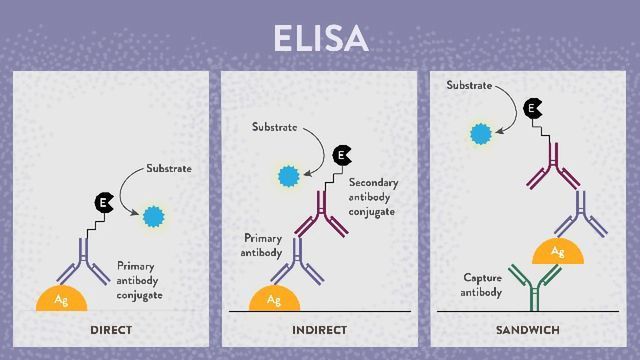 A diagram of three different types of ELISA. 