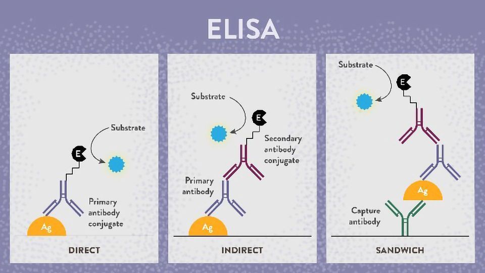 A diagram of three different types of ELISA.