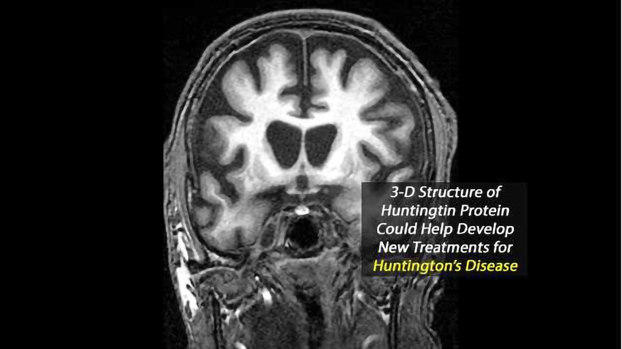 Decoding the 3-D Structure of Huntingtin