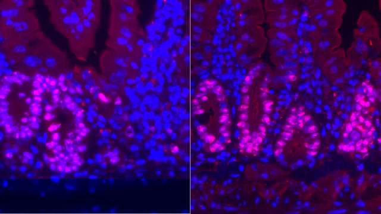 Low-calorie Diet Enhances Intestinal Regeneration After Injury