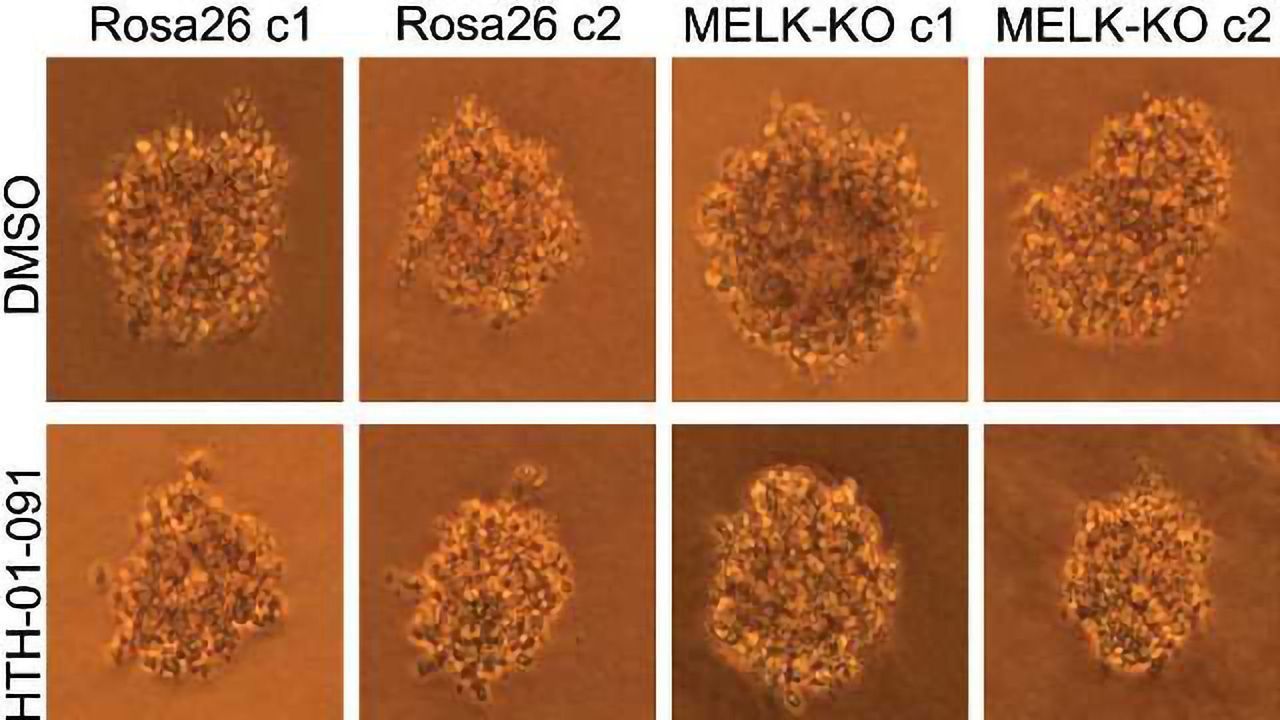 CRISPR Study Reveals Errors in Earlier Cancer Research
