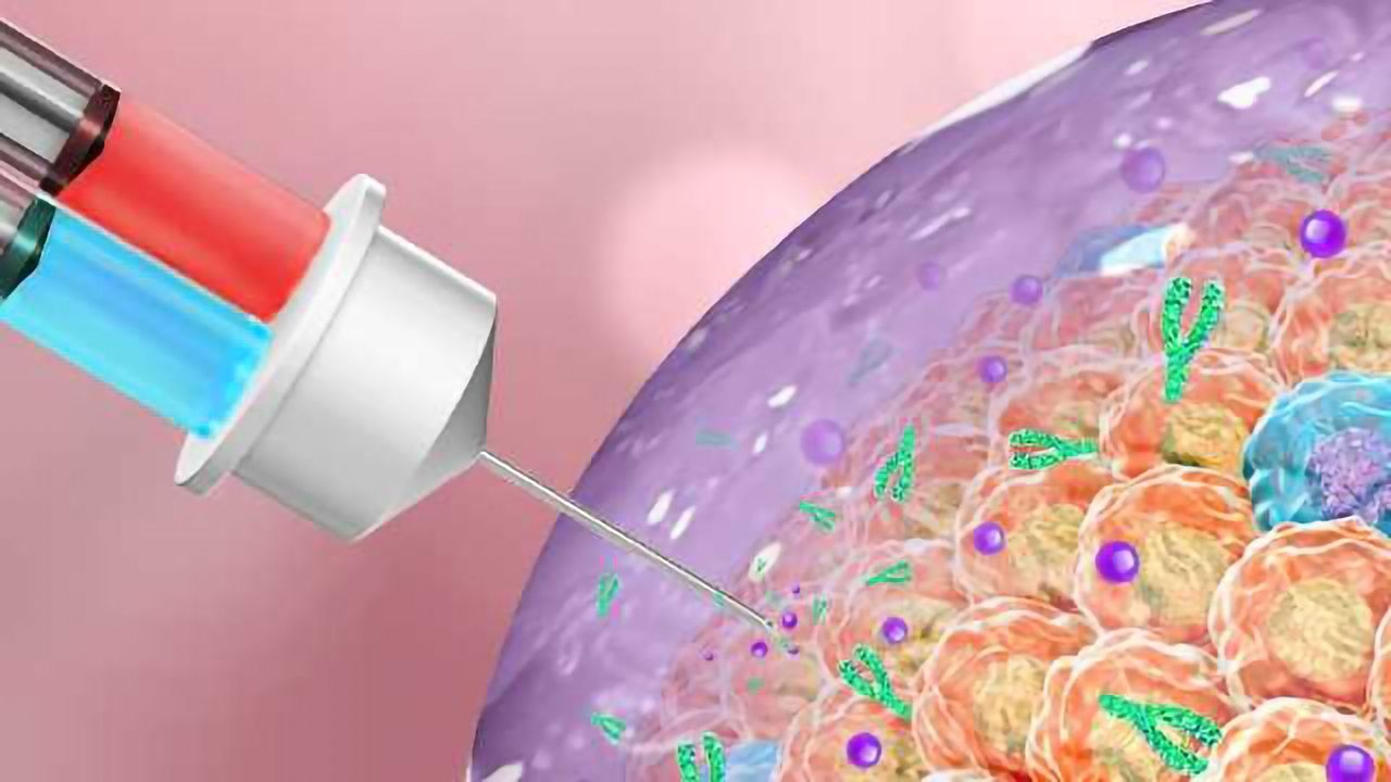 Therapeutic Gel Shows Promise Against Cancerous Tumors