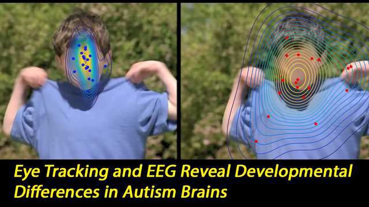 ‘Social Brain’ Networks are Altered at a Young Age in Autism