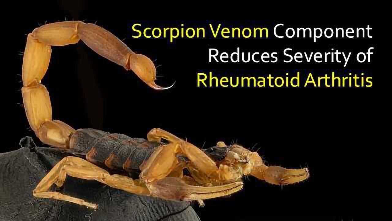 Component Found in Scorpion Venom Reduces Rheumatoid Arthritis Severity