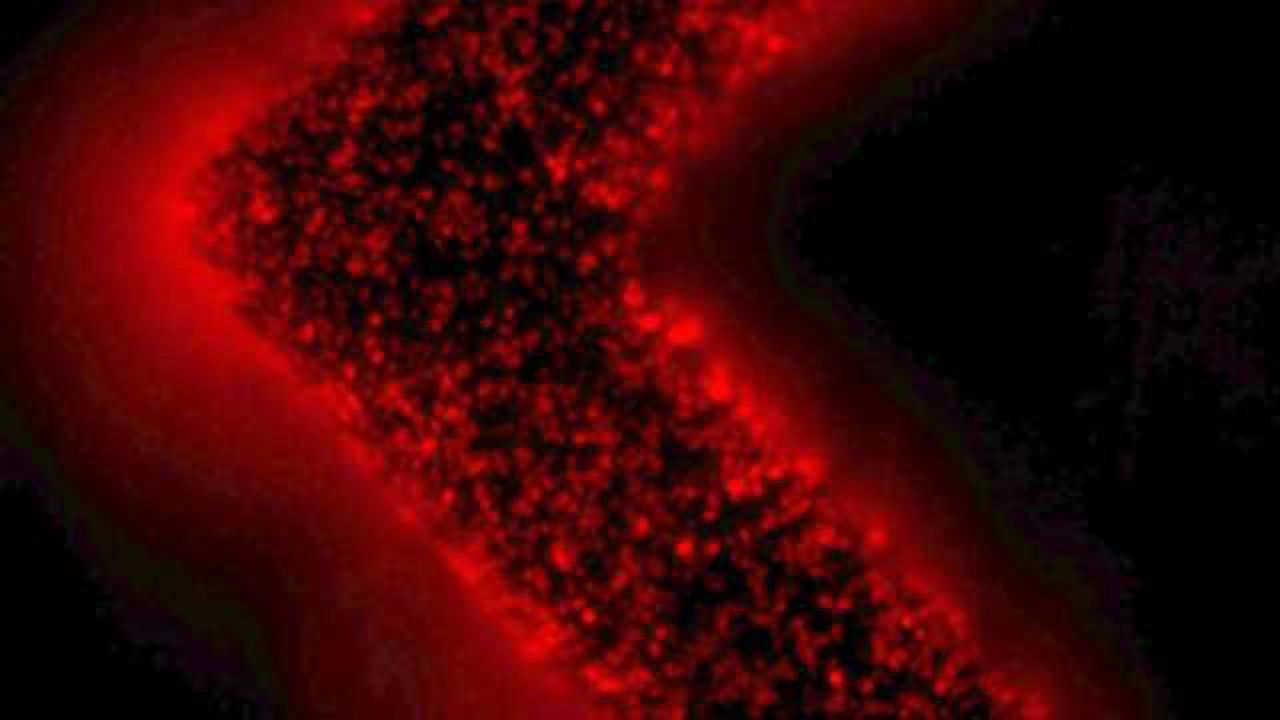 Microfluidic Device Captures Tumor-specific Extracellular Vesicles