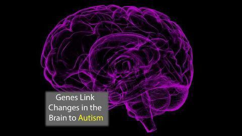 Genes Linked to Brain Anatomy in Autism Identified