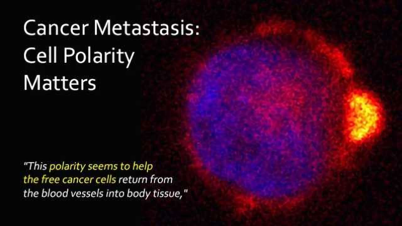 Cancer Metastasis: Cell Polarity Matters