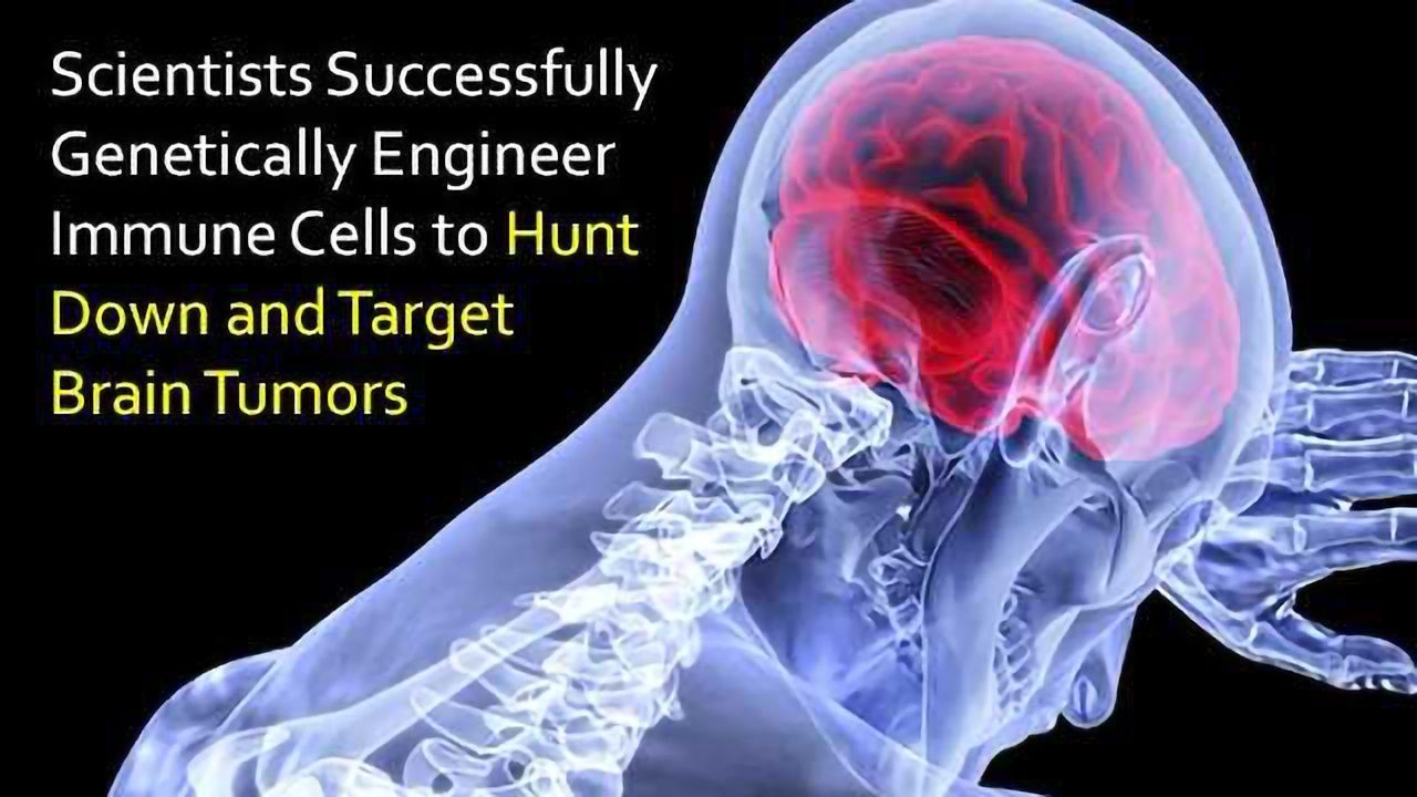Immune Cells Hunt Down Deadly Brain Tumors Thanks to Novel Target Molecule