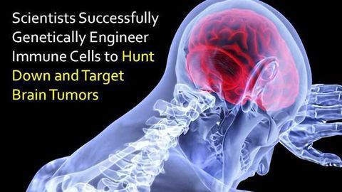 Immune Cells Hunt Down Deadly Brain Tumors Thanks to Novel Target Molecule