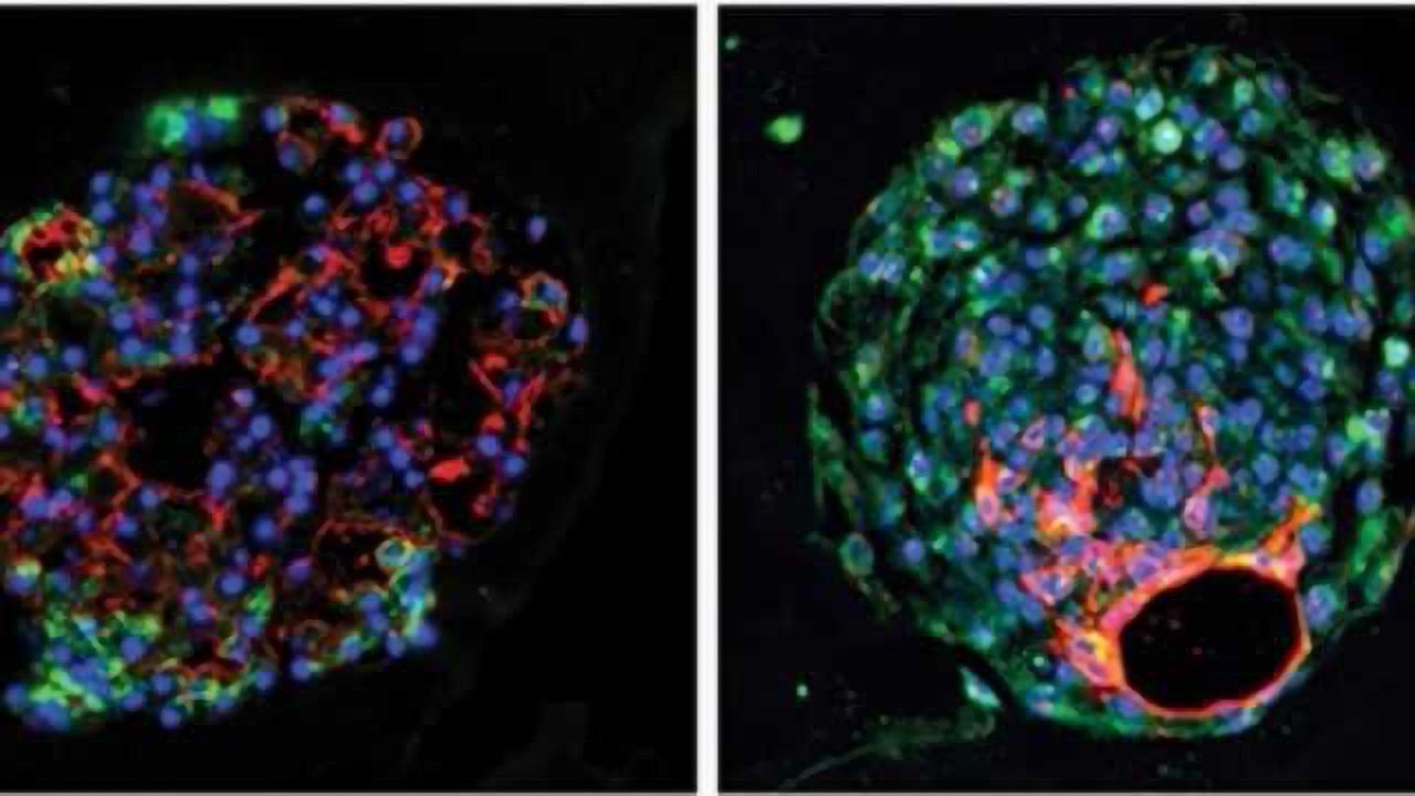 New-found Stem Cell Helps Regenerate Lung Tissue after Acute Injury