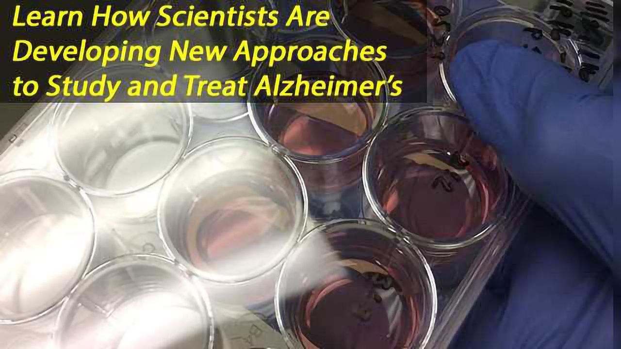 Stem-cell Study Points to New Approach to Alzheimer's Disease