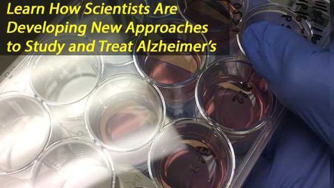 Stem-cell Study Points to New Approach to Alzheimer's Disease