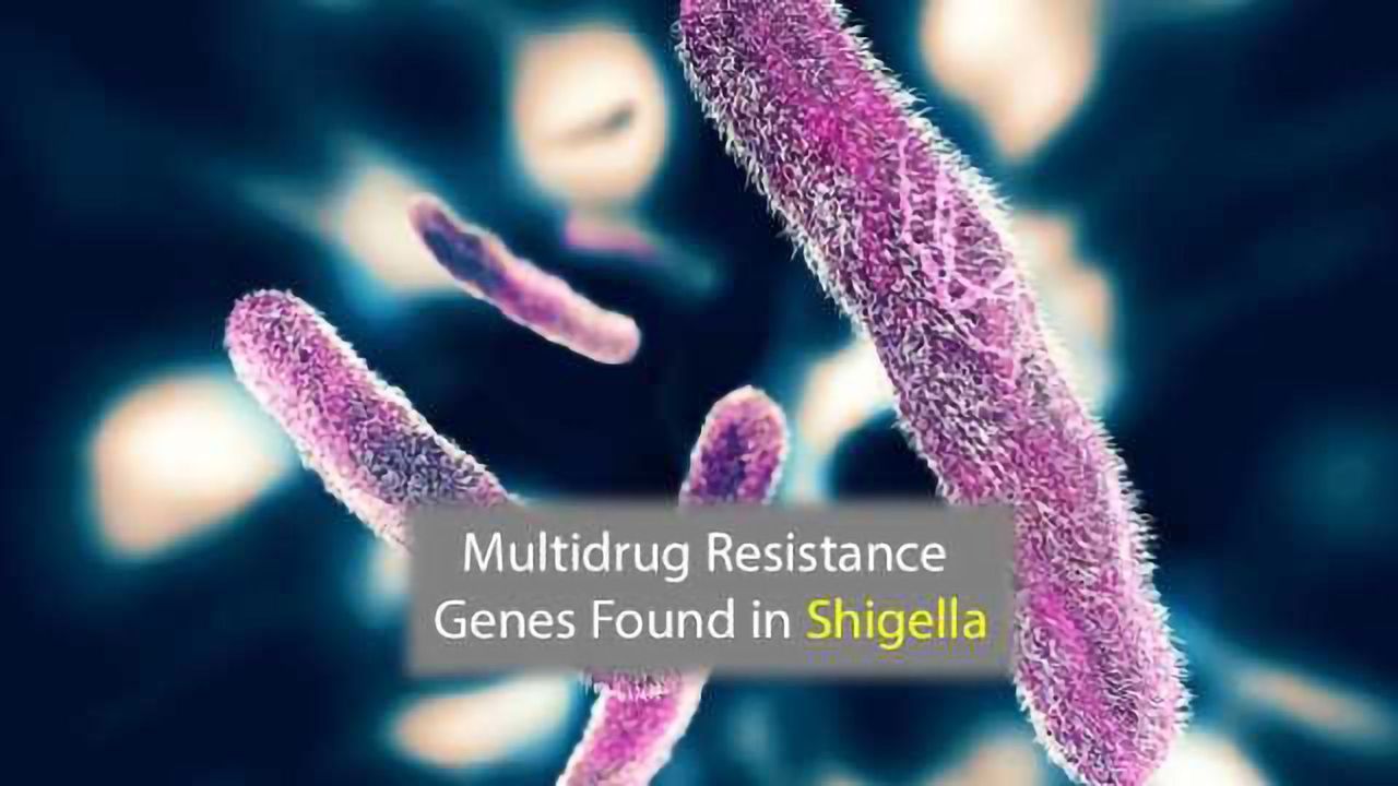 Multidrug Resistance Gene Detected in Shigella Isolates
