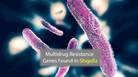 Multidrug Resistance Gene Detected in Shigella Isolates