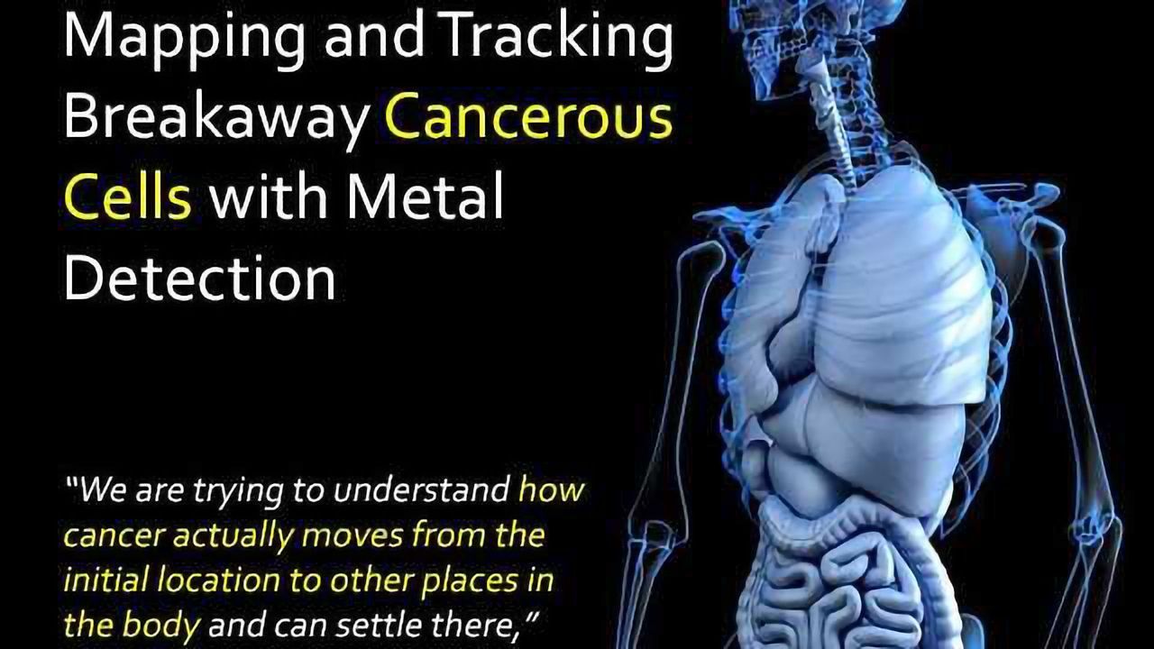 Mapping and Tracking Breakaway Cancerous Cells with Metal Detection
