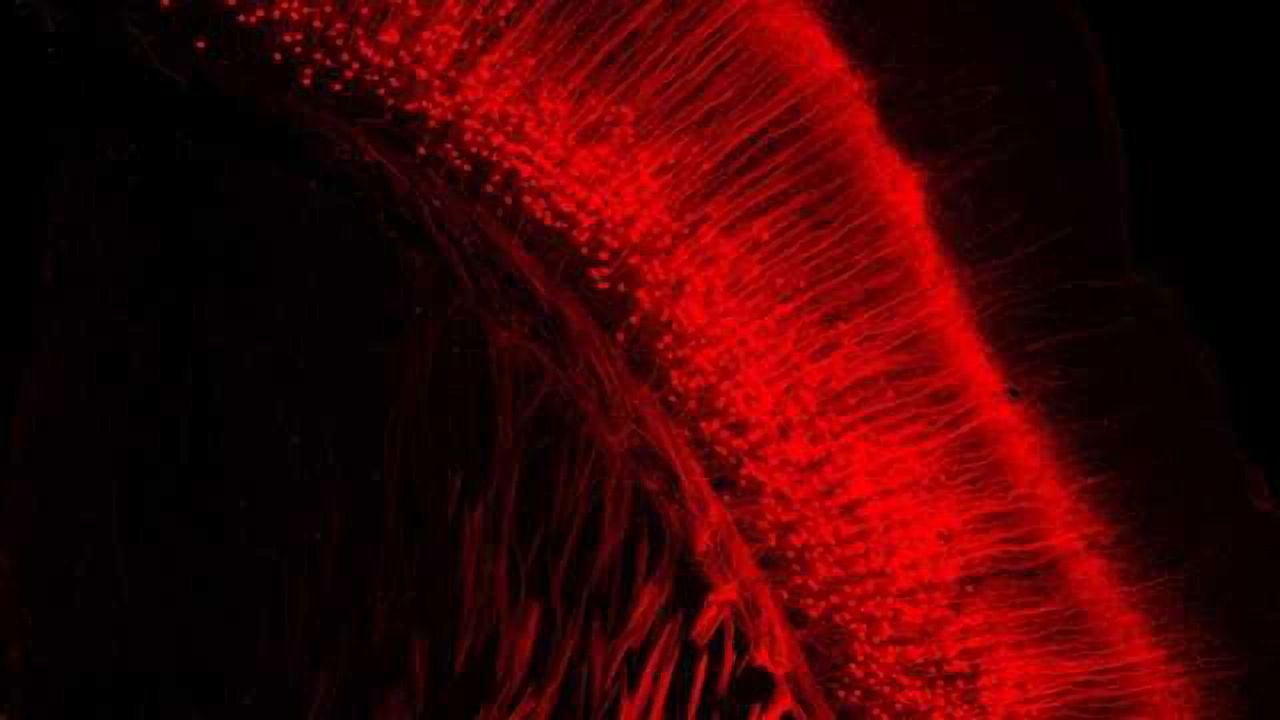 Viral Tool Traces Long-Term Neuron Activity