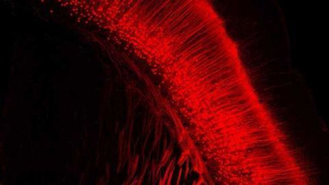 Viral Tool Traces Long-Term Neuron Activity