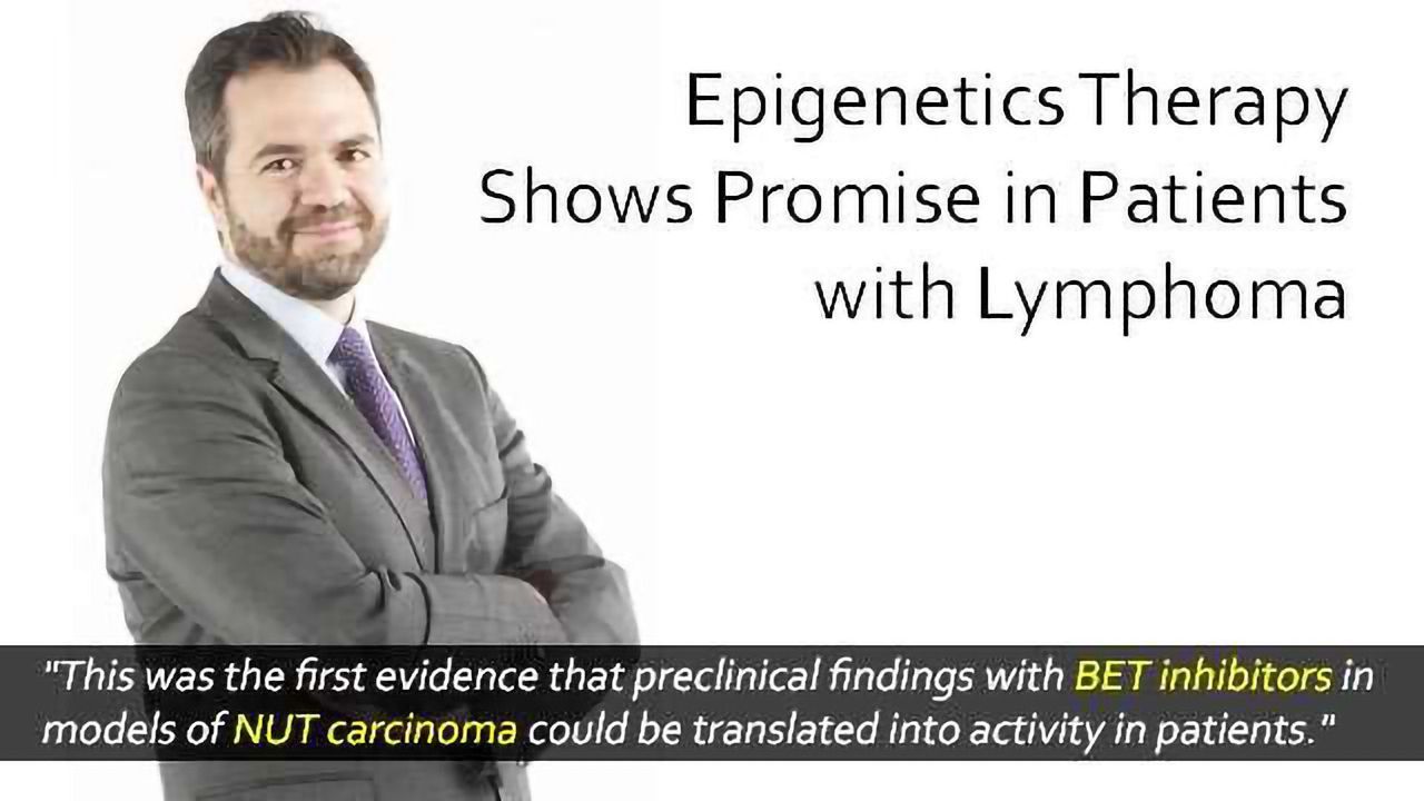 Compounds Targeting Epigenetics Show Promise in Lymphoma Patients