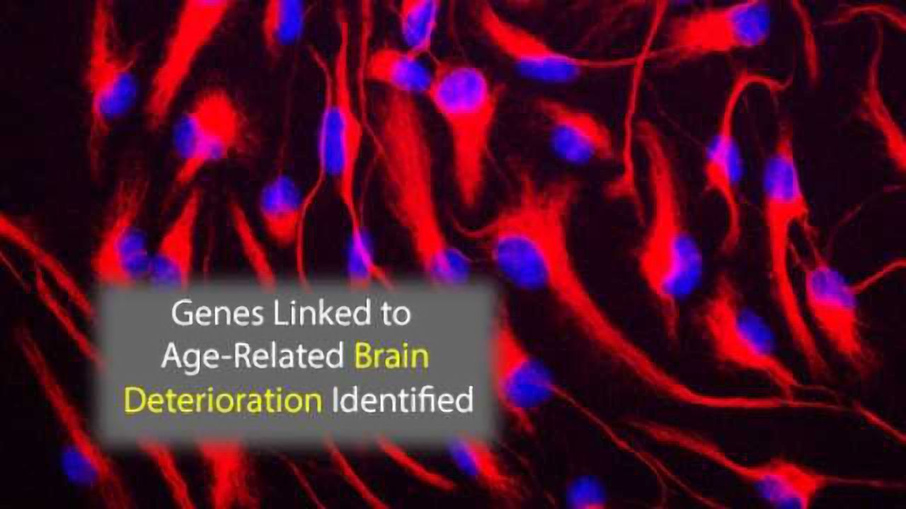 These Genes are Involved in Age-Linked Brain Deterioration