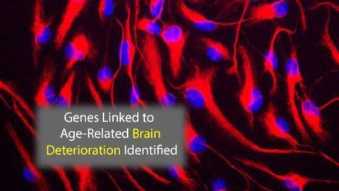 These Genes are Involved in Age-Linked Brain Deterioration