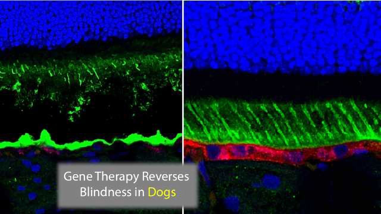 Best Disease Blindness Bettered By Gene Therapy
