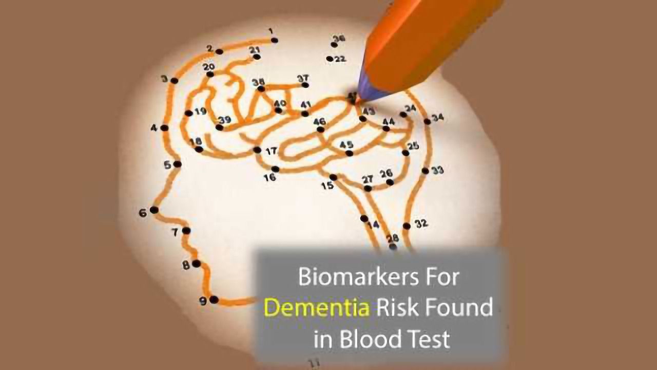 Biomarkers Signal Risk of Future Dementia