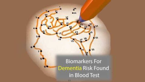 Biomarkers Signal Risk of Future Dementia