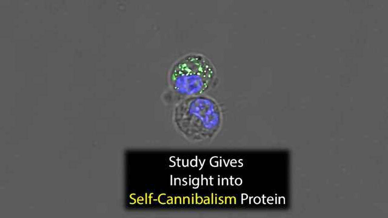 Imaging Brings Central Protein in Cellular Self-Cannibalism into Sharp Focus