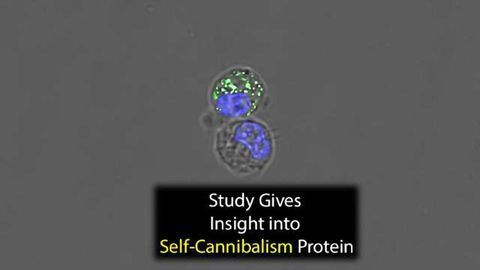 Imaging Brings Central Protein in Cellular Self-Cannibalism into Sharp Focus