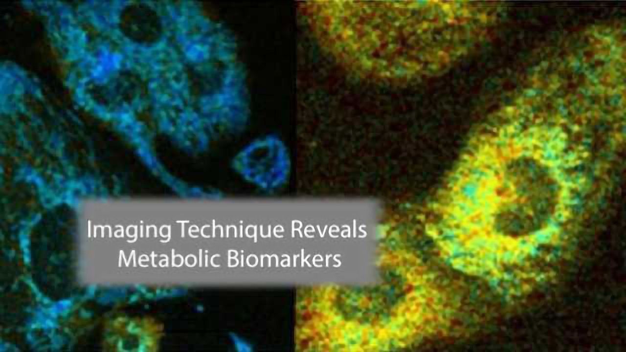 Imaging Technique Lasers In On Disease Biomarkers