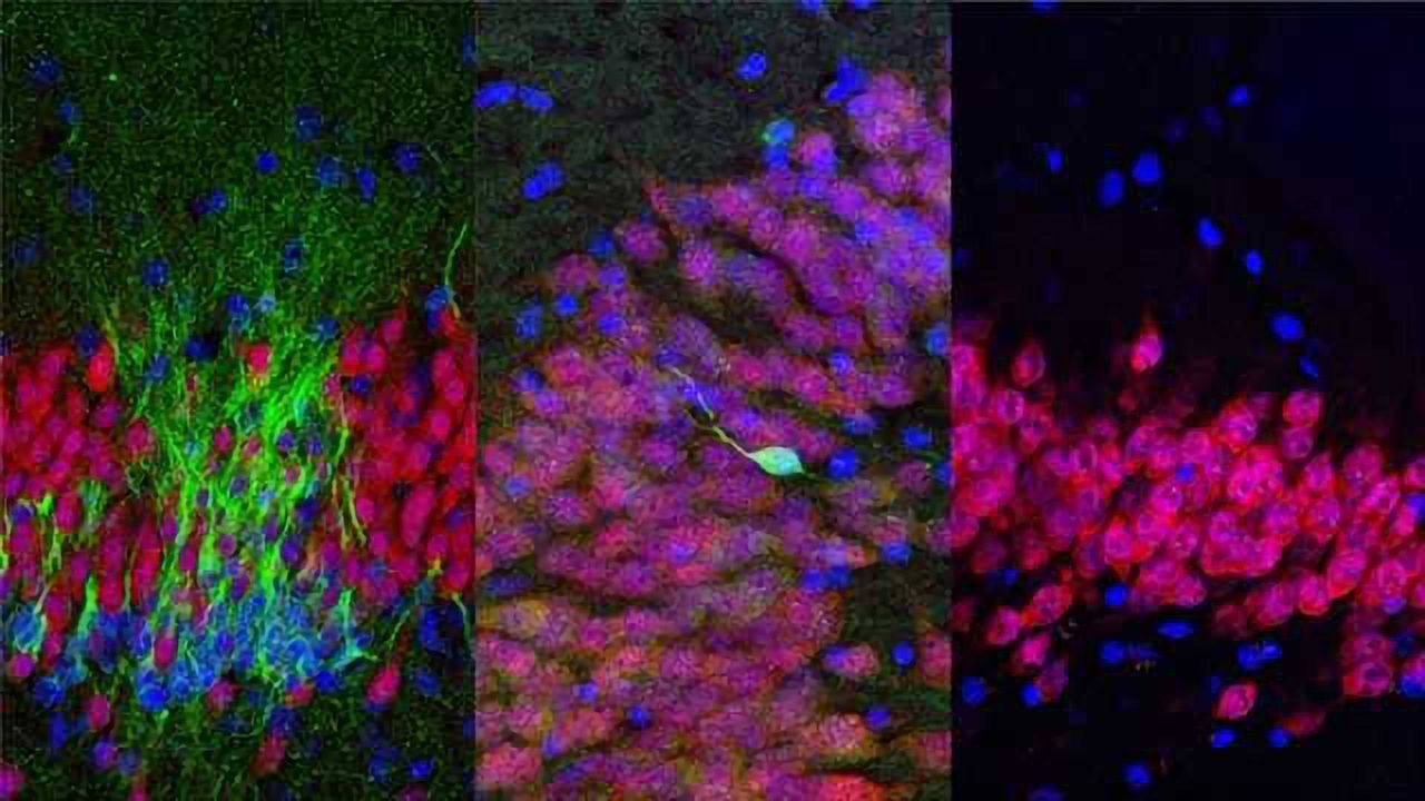 Birth of New Neurons in the Human Hippocampus Ends in Childhood