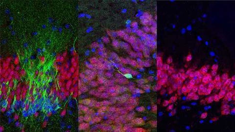 Birth of New Neurons in the Human Hippocampus Ends in Childhood