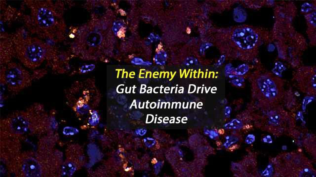The Enemy Within: Gut Bacteria Drive Autoimmune Disease