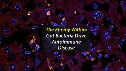 The Enemy Within: Gut Bacteria Drive Autoimmune Disease
