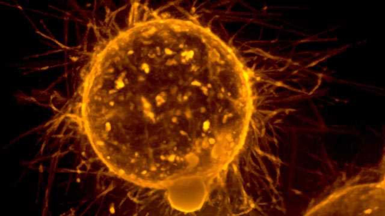 New Targeted Therapy Could Combat Drug Resistant Cancer Cells