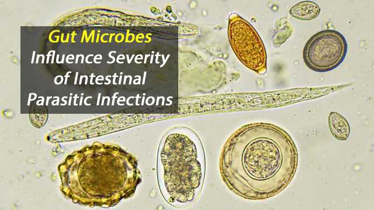 Manipulating Gut Microbiome May Protect Against Intestinal Parasites