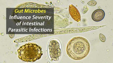 Manipulating Gut Microbiome May Protect Against Intestinal Parasites