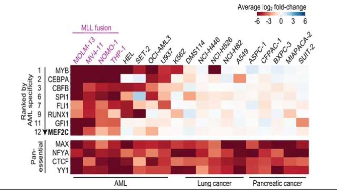 CRISPR-Based System Identifies New Drug Targets in Aggressive Leukemia