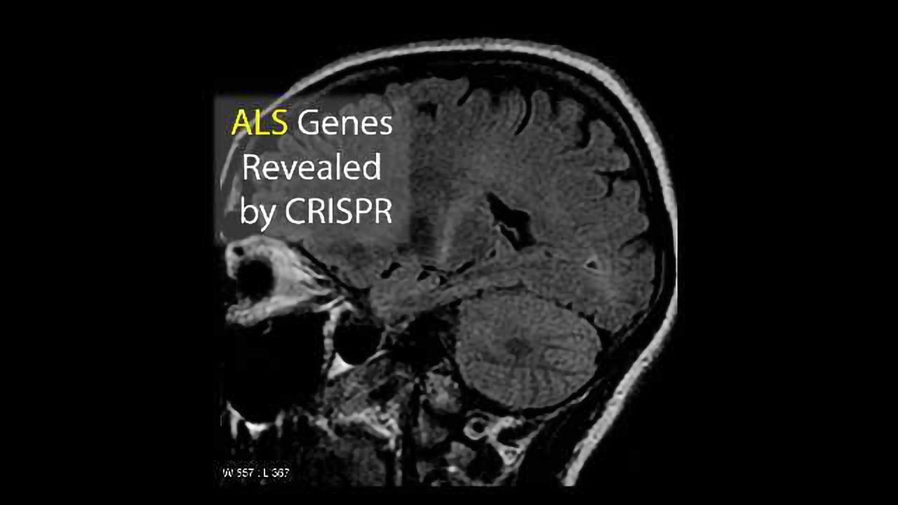 CRISPR Scans Entire Human Genome For ALS Mutations in Just Two Weeks