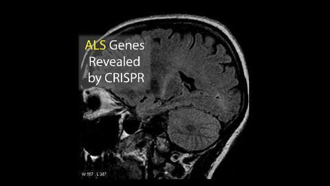 CRISPR Scans Entire Human Genome For ALS Mutations in Just Two Weeks