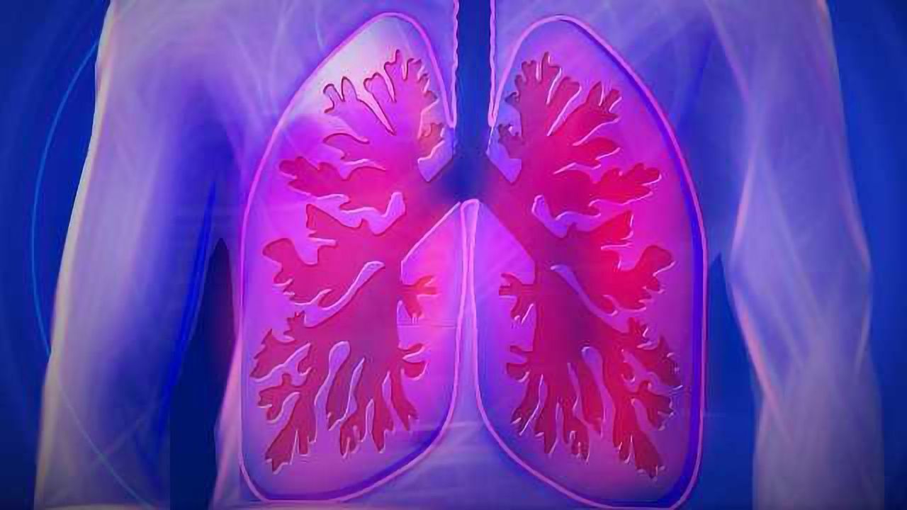 New Method to Rule out Early Stage Lung Cancer