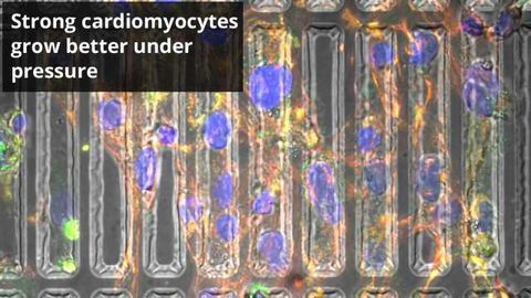 Mending Broken Hearts with Cardiomyocyte Molds