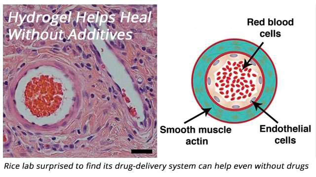 Drug-Delivery System Can Help Heal Even Without Drugs